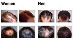 Esencia orgánica para el crecimiento del cabello